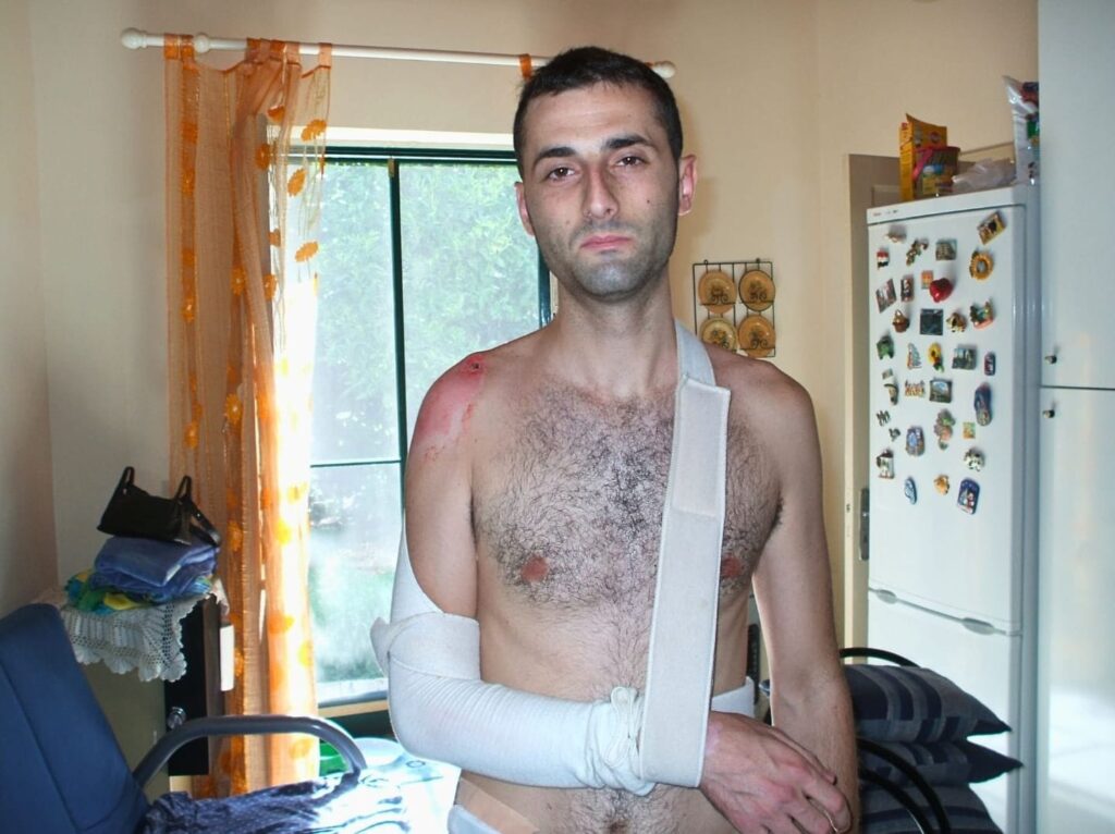 mio incidente in moto